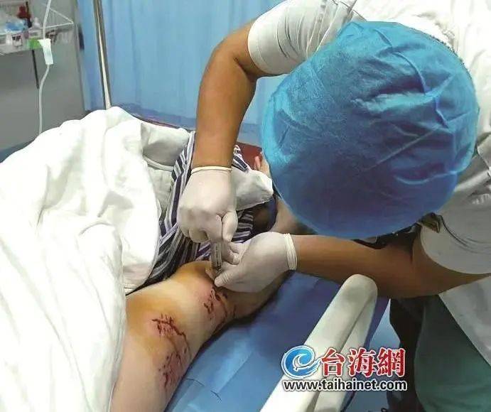 手臂肌腱被咬断！近期激增<strong></p>
<p>金特币交易平台</strong>，半个月接诊近200例……