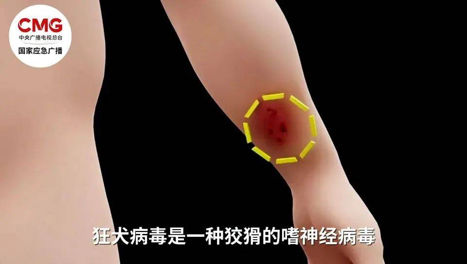 手臂肌腱被咬断！近期激增<strong></p>
<p>金特币交易平台</strong>，半个月接诊近200例……