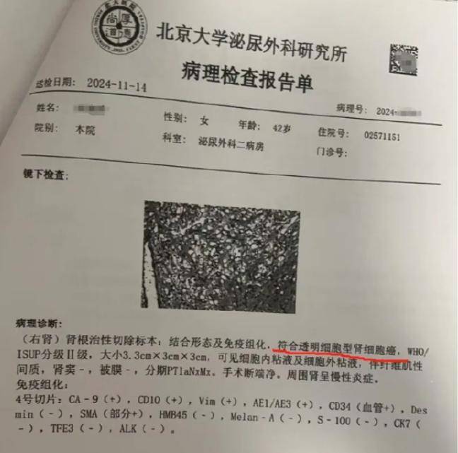 女律师十年体检未查出癌症<strong></p>
<p>vgs在哪个平台有交易</strong>，爱康国宾发布情况说明
