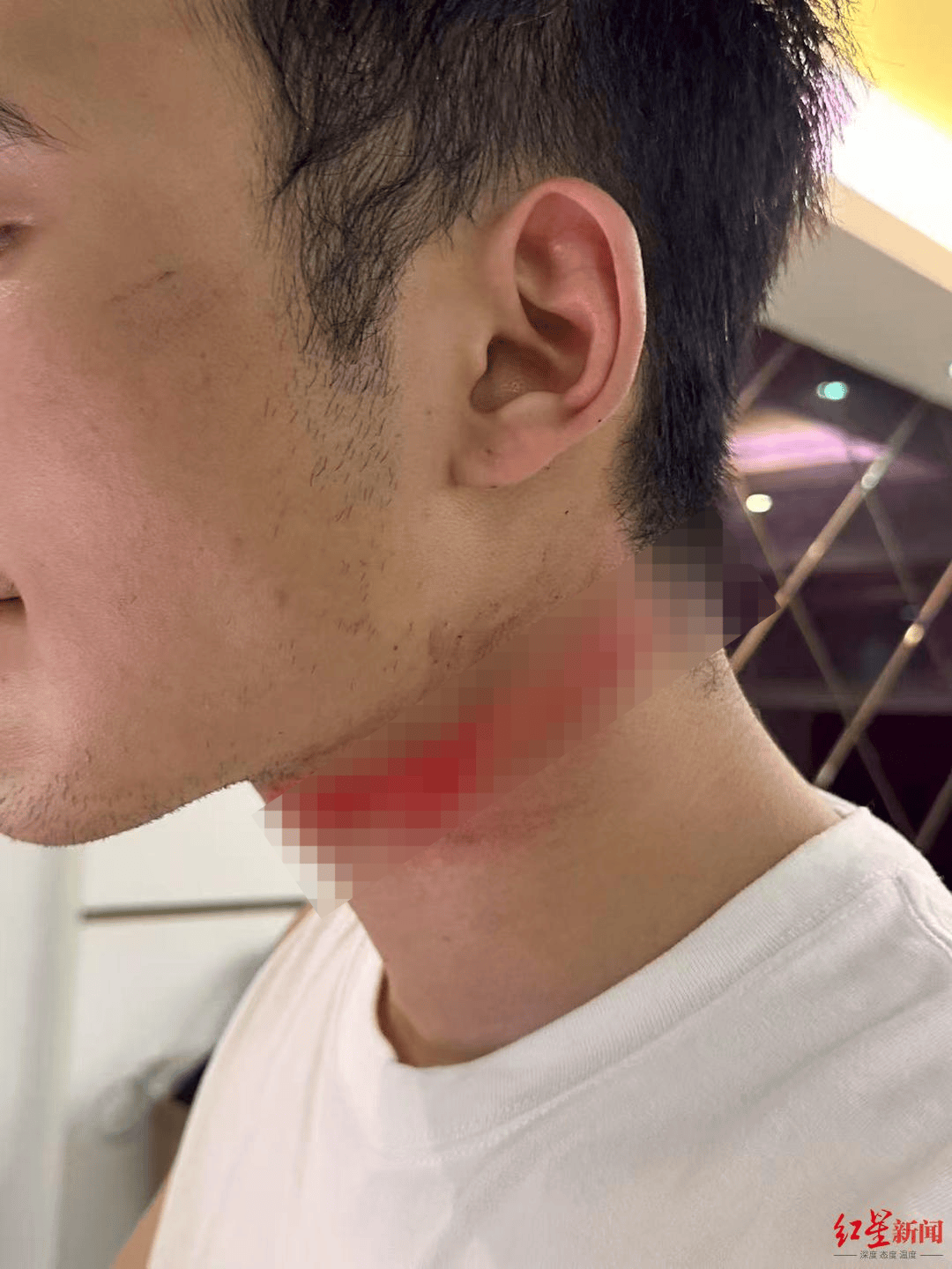 男主播骑车载女友回家被路边掉落网线勒伤脖子<strong></p>
<p>300386股票</strong>，索赔3万陷僵局 律师解读该谁赔