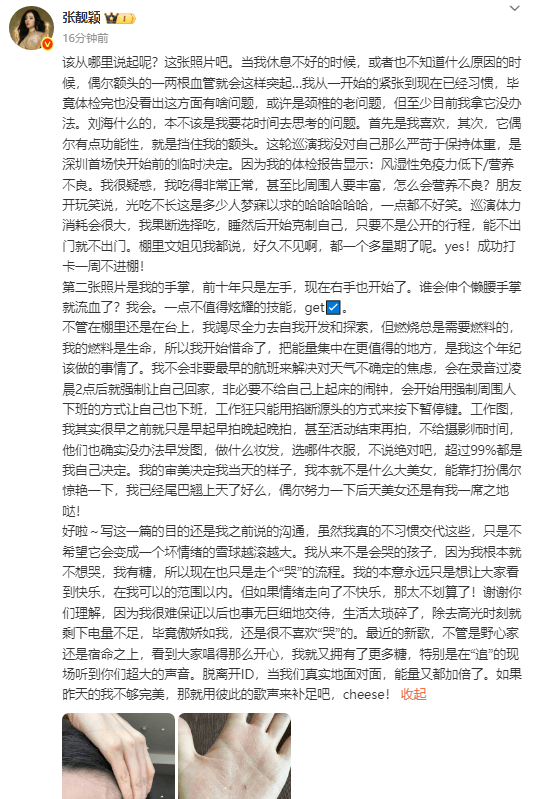 张靓颖发长文谈身体近况 称自己开始惜命<strong></p>
<p>000725京东方股票行情</strong>了