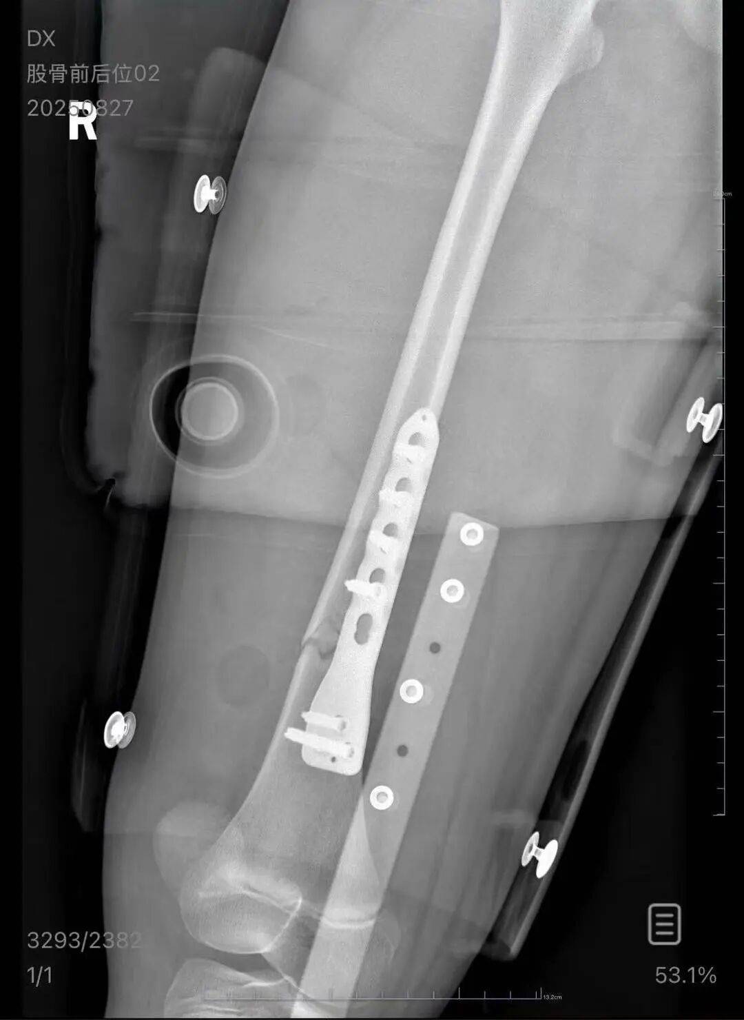男子火车上铺跌落砸断10岁女孩腿骨<strong></p>
<p>理邦仪器股票</strong>,回应“失联”称失业讨薪中