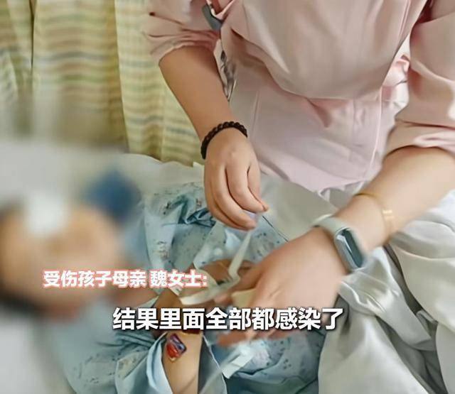 江西一5岁男孩在幼儿园被戳伤致左眼失明<strong></p>
<p>鲁信创投股票</strong>,家长称老师用猪油涂抹试图消肿