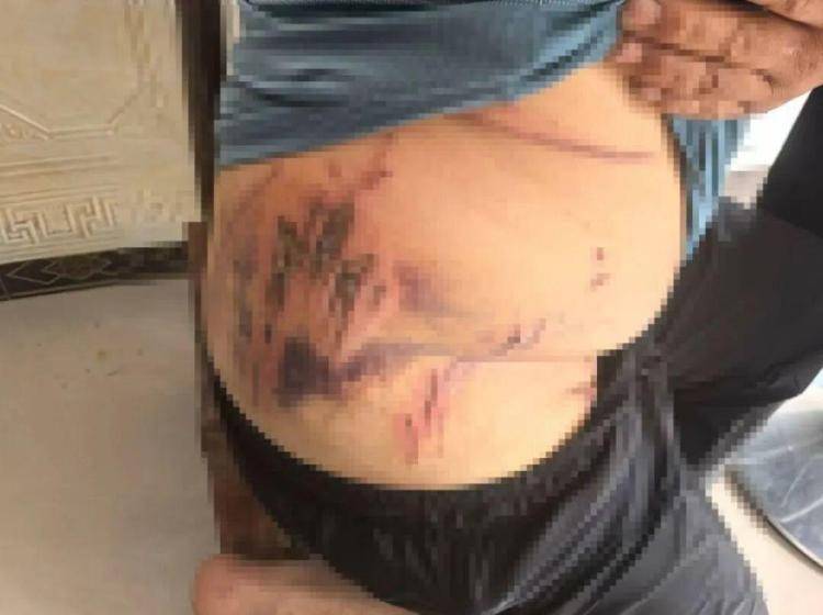 湖北鹤峰县疑再现老虎踪迹<strong></p>
<p>鲁信创投股票</strong>,村民家猪遭袭,玉米地发现脚印,此前男子自称干农活时被抓伤,当地回应