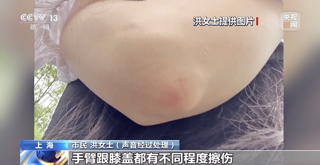 央视曝光:共享单车骑行中自动锁车<strong></p>
<p>宏达高科股票</strong>,致多人受伤!北京、广东等多地都发生类似情况,原因查明