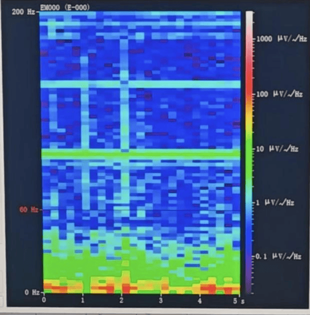 山西首例<strong></p>
<p>连云港股票</strong>!山西省人民医院成功实施脑机接口辅助功能区脑肿瘤切除手术